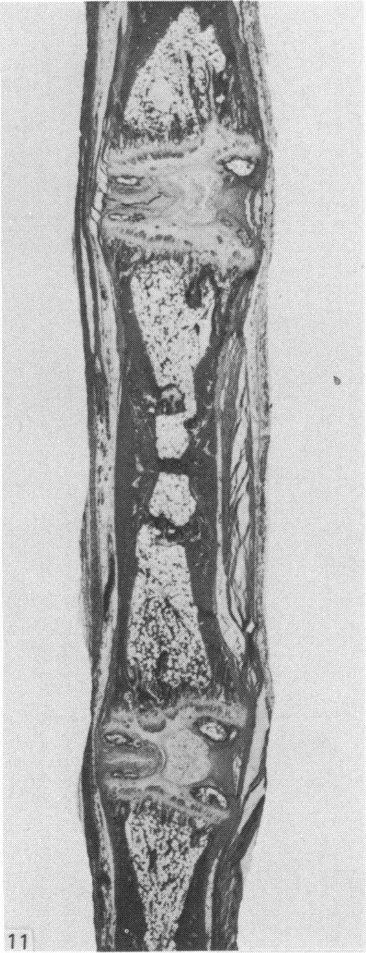 Fig. 11