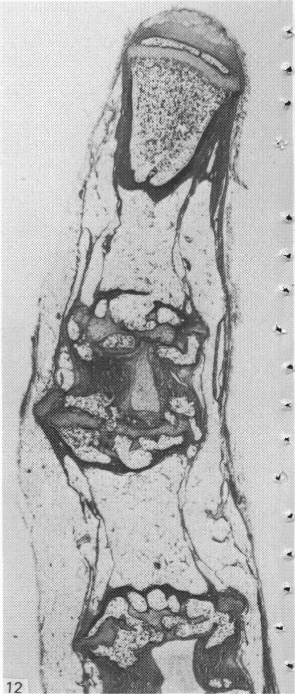 Fig. 12