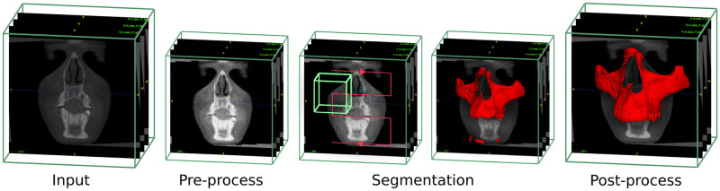 Fig 4