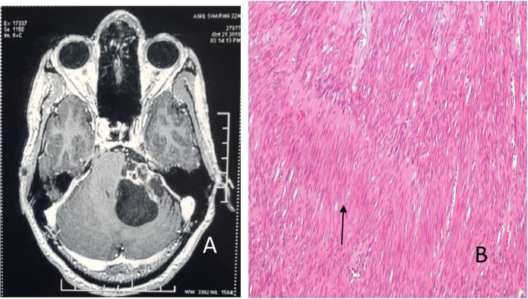Fig. 1