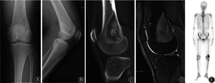 FIGURE 1
