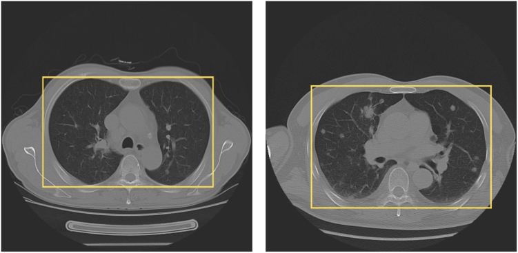 Fig. 3