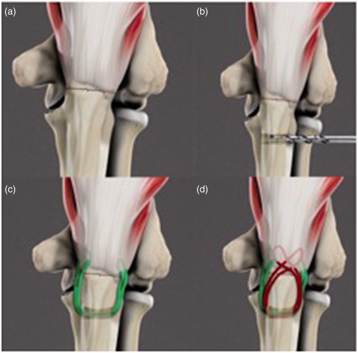 Figure 2.