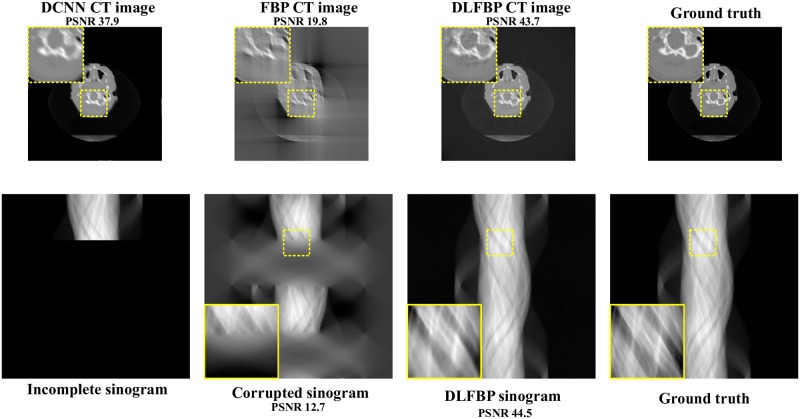 Fig 11