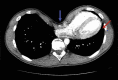 Fig. 6