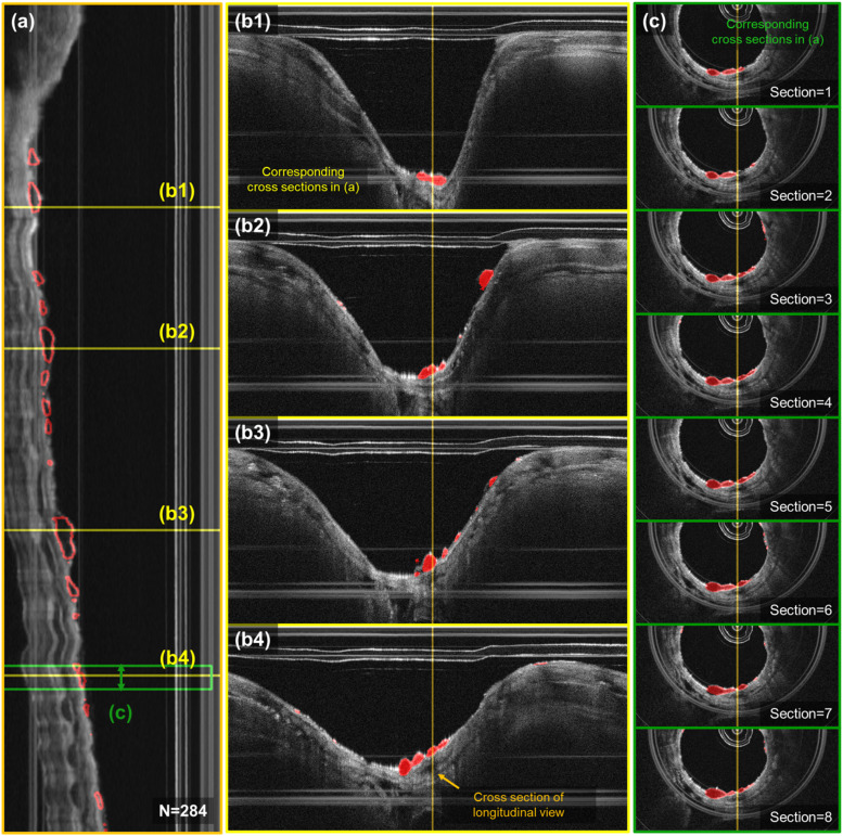 FIG. 6.