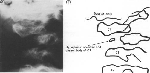 Fig 8a and b