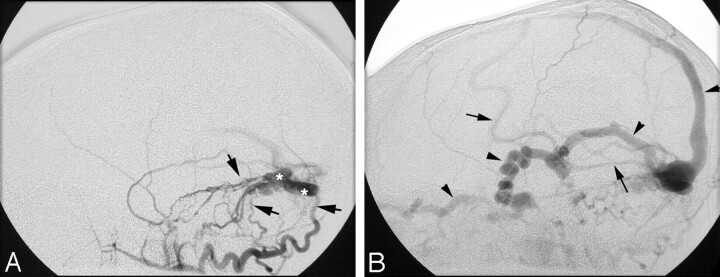 Fig 2.