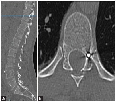 Figure 2: