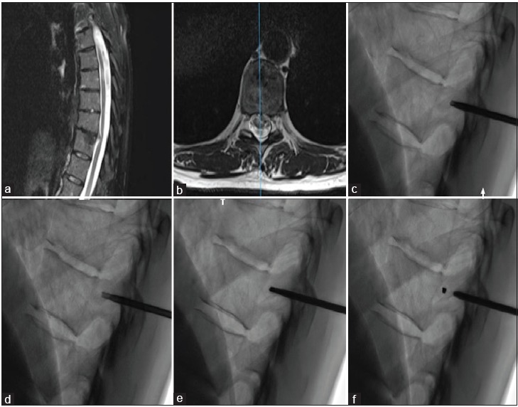 Figure 1: