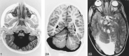 <sc>fig</sc> 1.