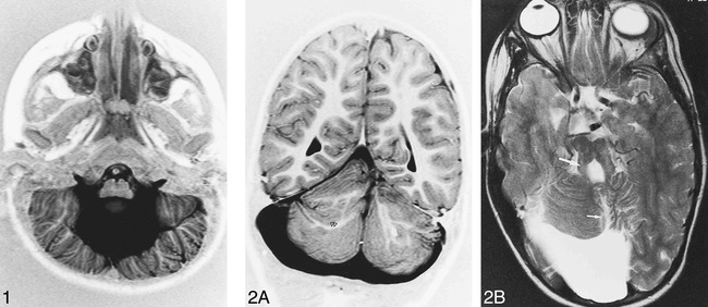 fig 2.