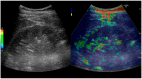 Figure 32