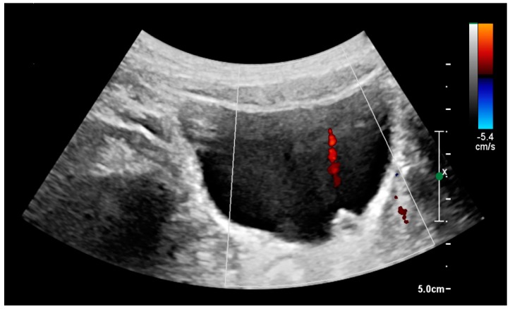 Figure 21