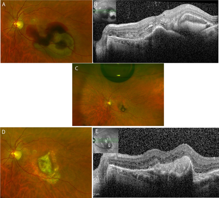 Fig. 1