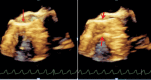 Figure 9