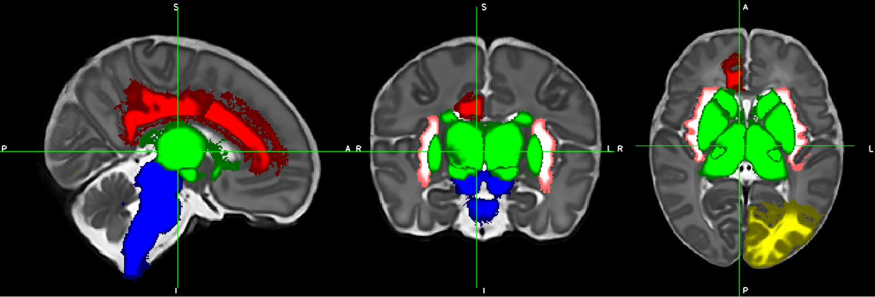 Figure 2.