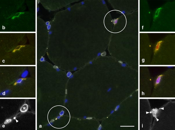 Fig. 1