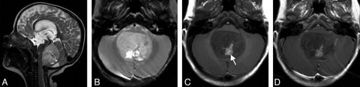 Fig 2.