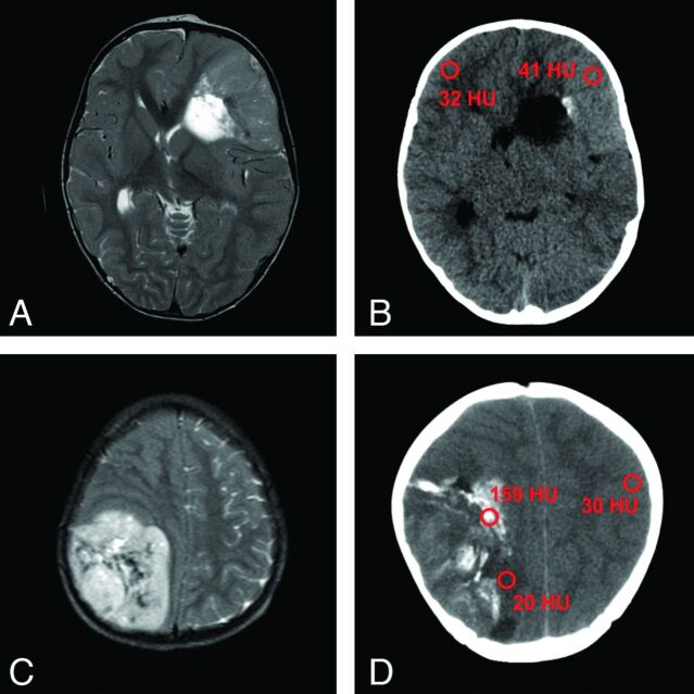 Fig 6.