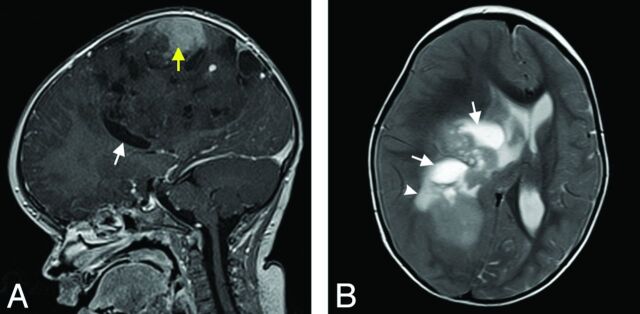 Fig 3.