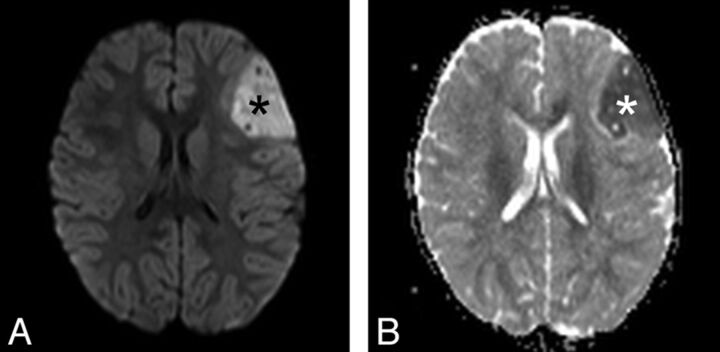 Fig 5.