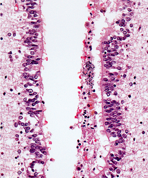 Figure 2j