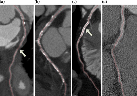 Fig. 10