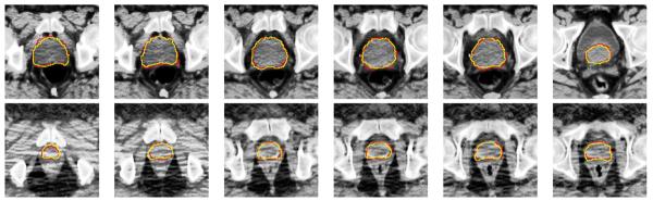 Fig. 20