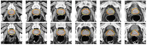 Fig. 12