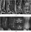 Fig 3A