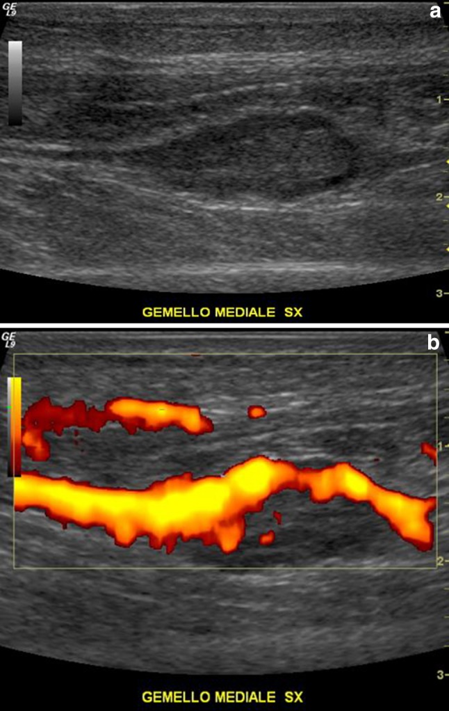 Fig. 1