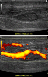 Fig. 1