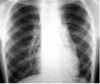 Fig. 12