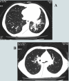 Fig. 8