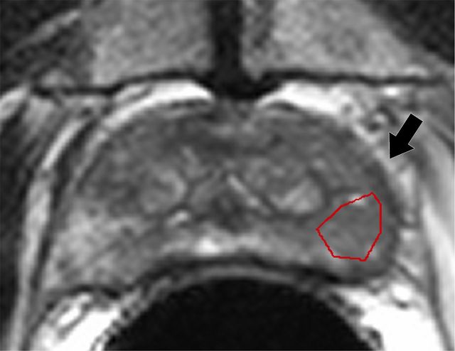 Figure 1a: