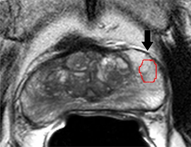 Figure 1b: