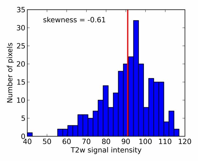 Figure 1d: