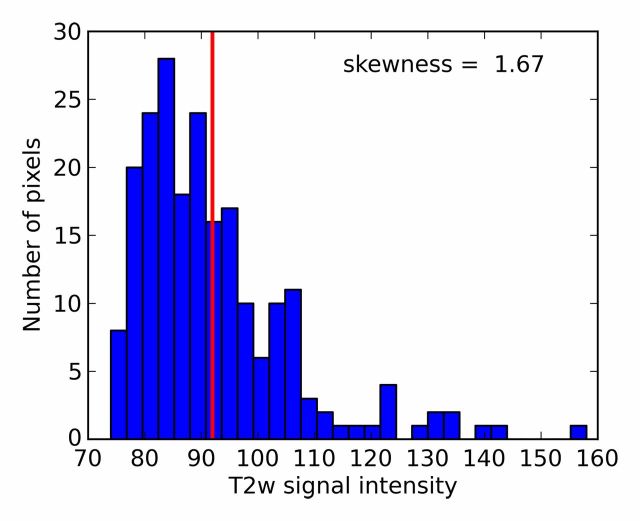 Figure 1c: