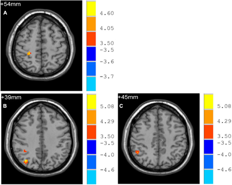 FIGURE 3