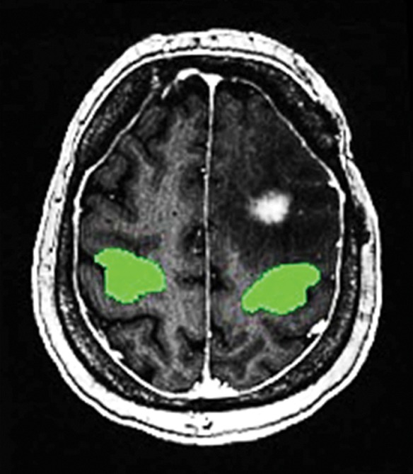 Figure 2b: