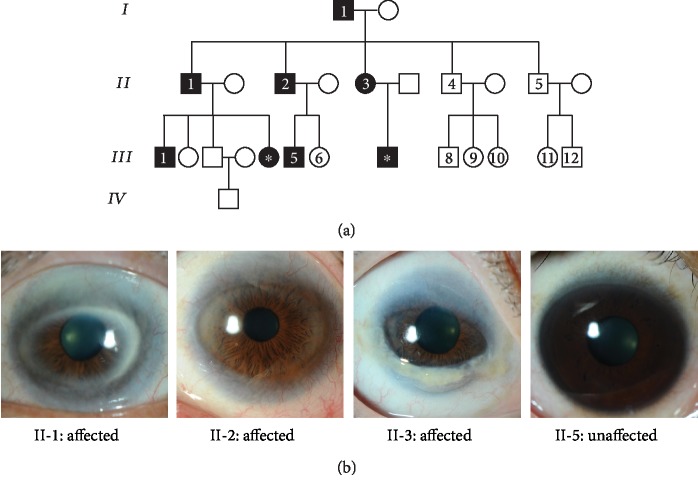 A Cohesin Subunit Variant Identified from a Peripheral Sclerocornea ...