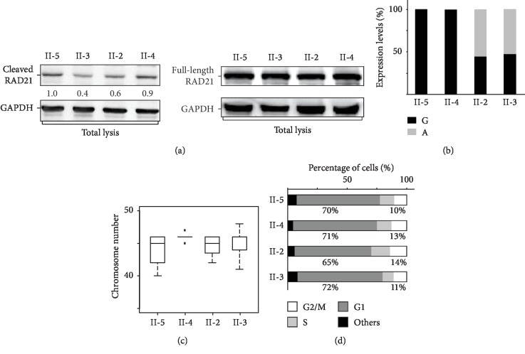 A Cohesin Subunit Variant Identified from a Peripheral Sclerocornea ...