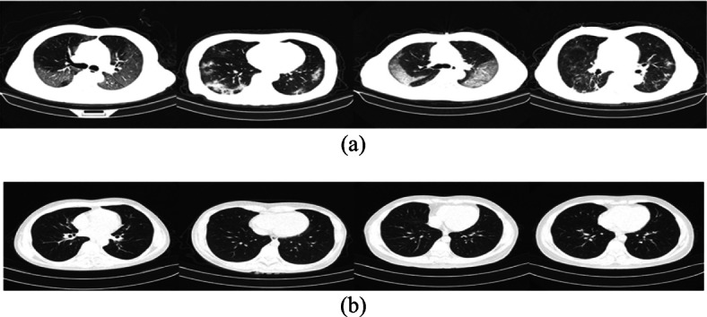 Fig. 15