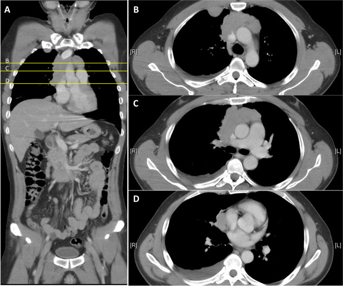 Fig. 2