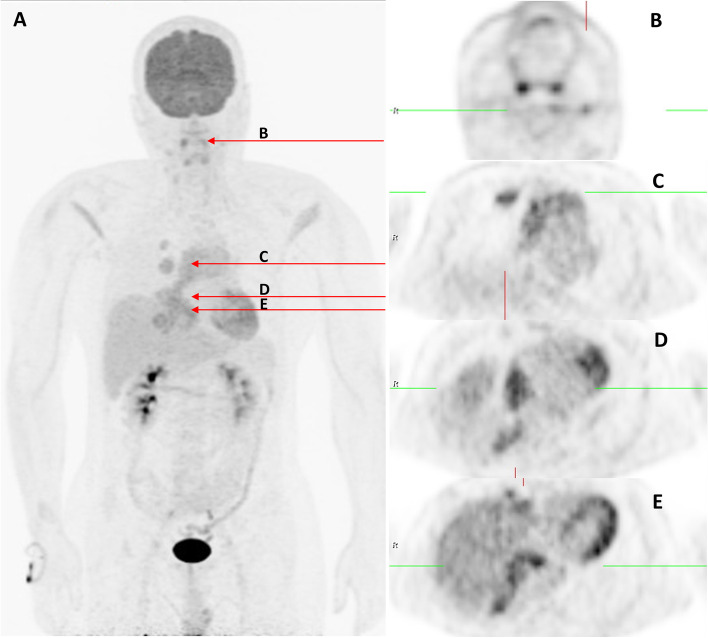 Fig. 3