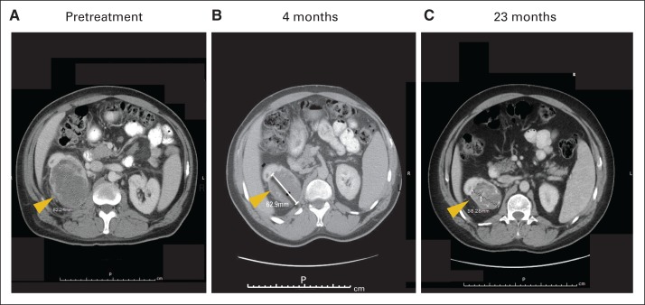 Fig 2.