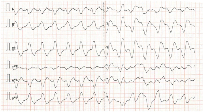 FIGURE 1