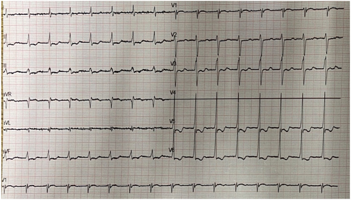 FIGURE 3