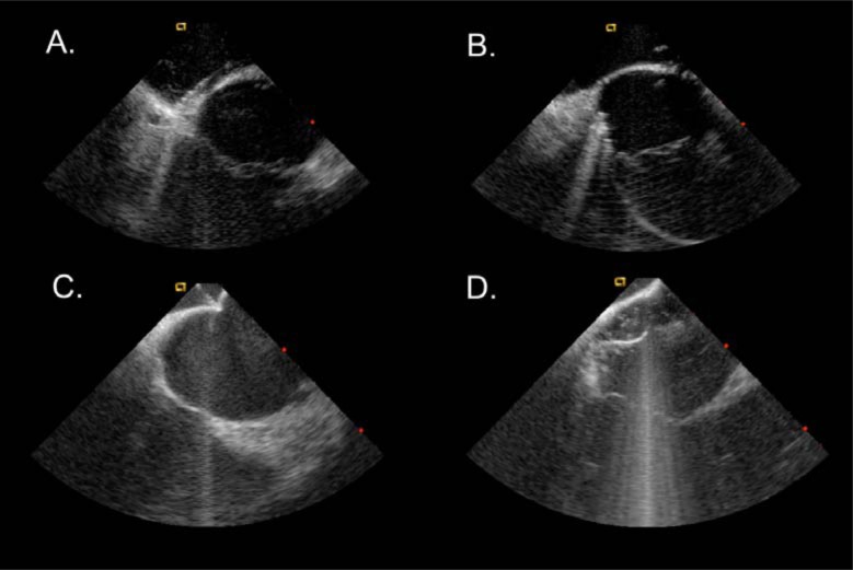 Fig. (5)